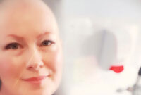 Lecturer is raising money for Prince Philip Hospital’s breast care unit