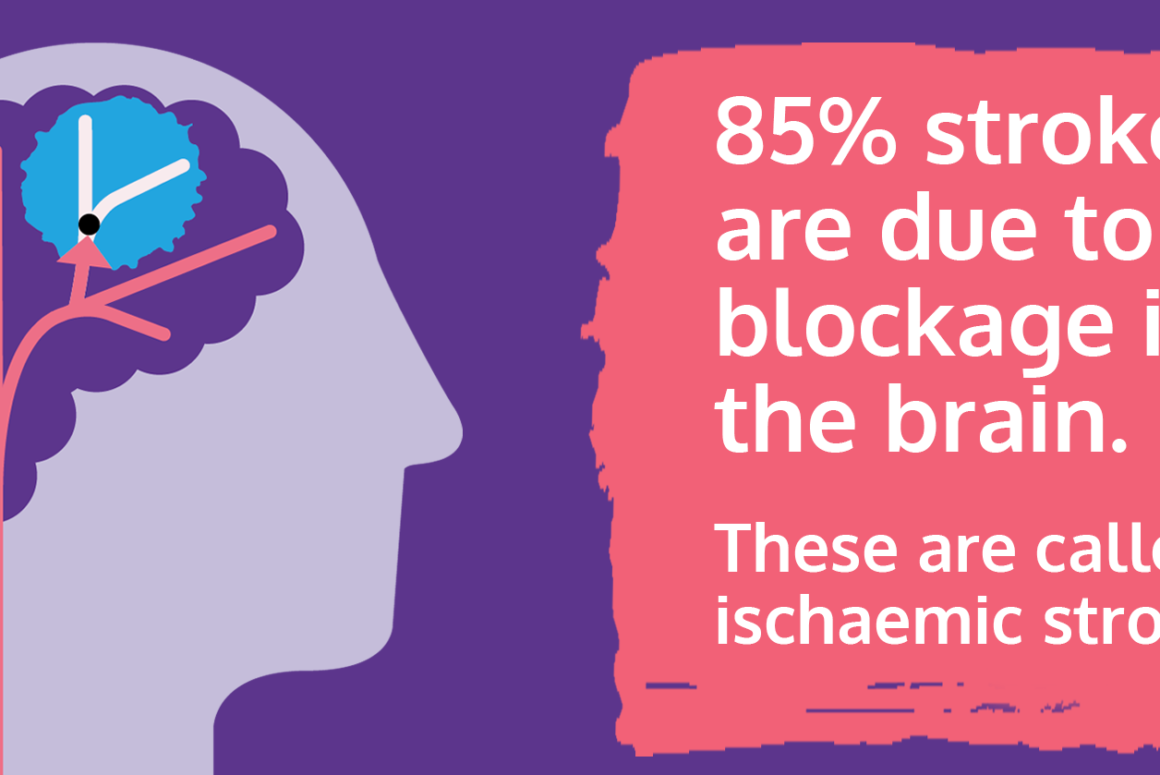 Stroke Association and Hope After a Stroke