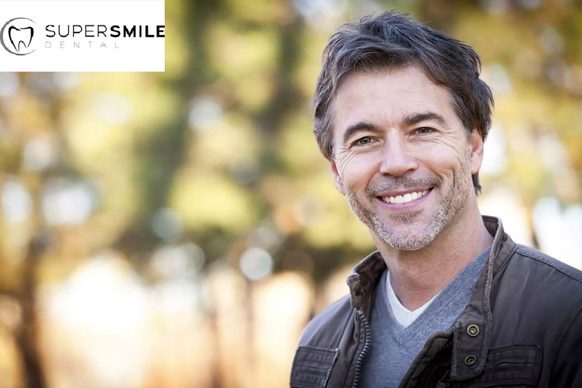3 Surprising Dental Implant Facts by Super Smile Dental