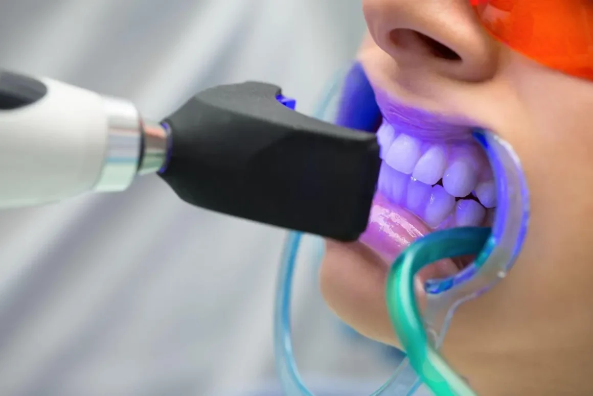 Brighten Your Smile with Teeth Whitening Treatment