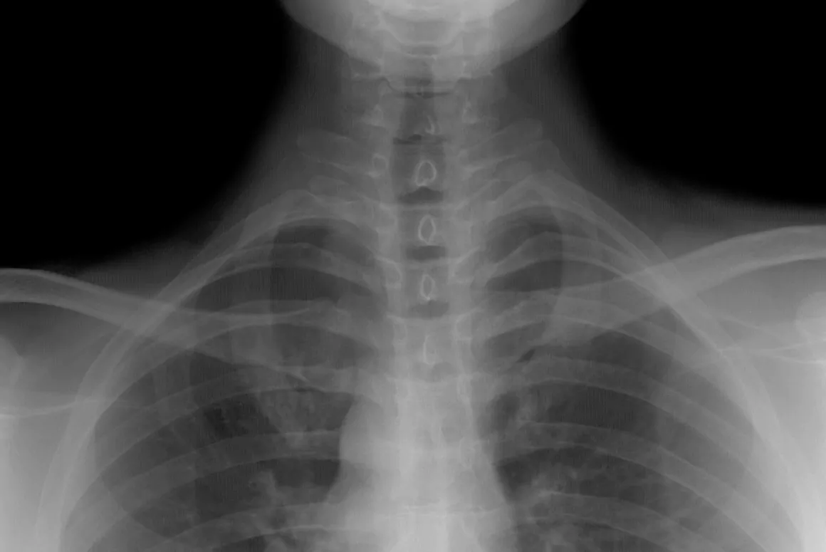 Researchers Create AI to Examine Medical Images