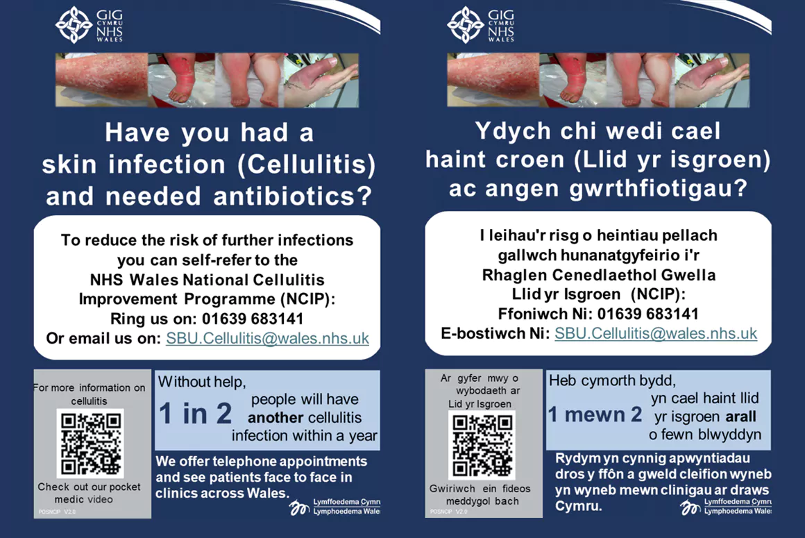 National Cellulitis Improvement Programme To Raise Awareness